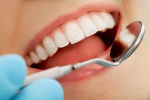 İmplant 14 implant