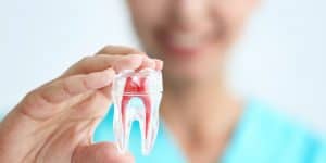 Kanal Tedavisi Nasıl Yapılır ve Fiyatları 15 endodonti