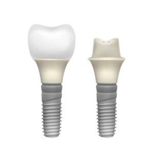 Dental implant 14 dental implant